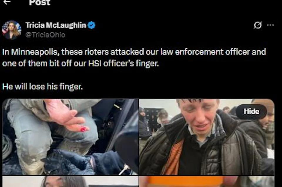 5385678189640858 image