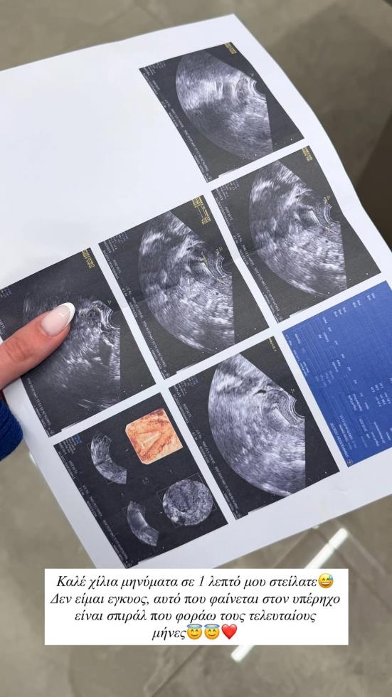 5425352977844862 image