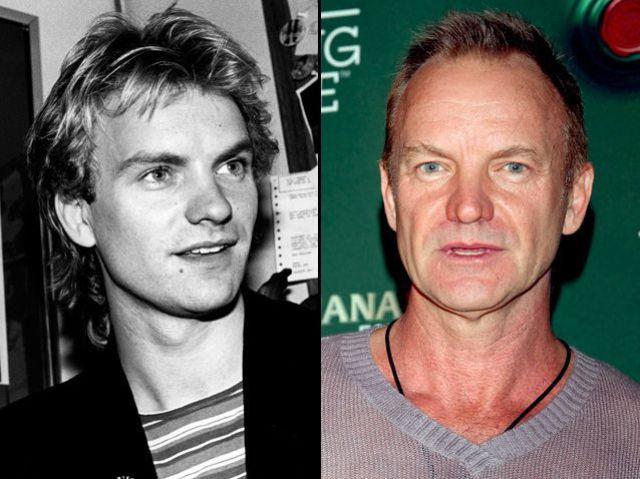Sting