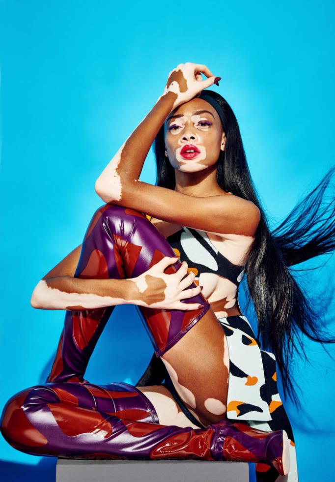 Winnie Harlow