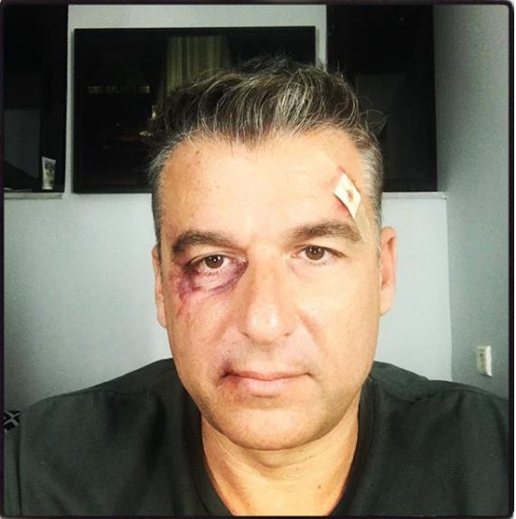 ΓΙΩΡΓΟΣ ΛΙΑΓΚΑΣ