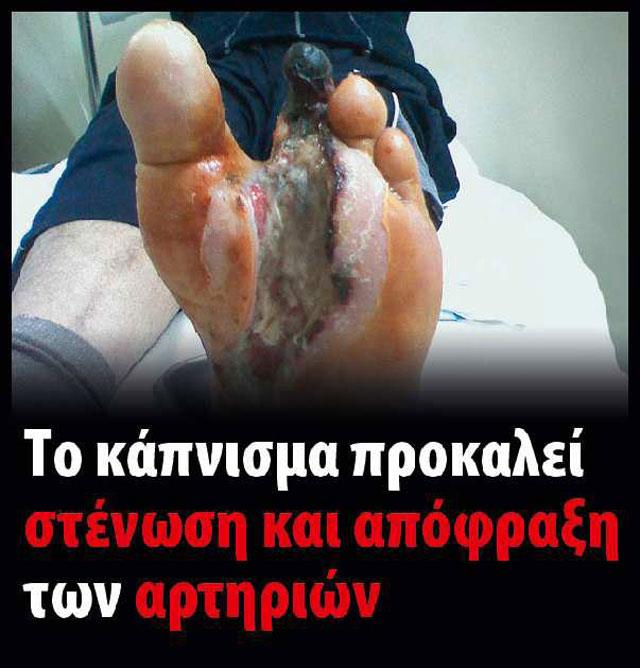 καπνισμα 4