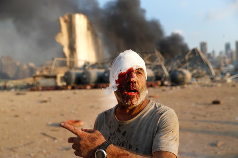 APTOPIX Lebanon Explosion