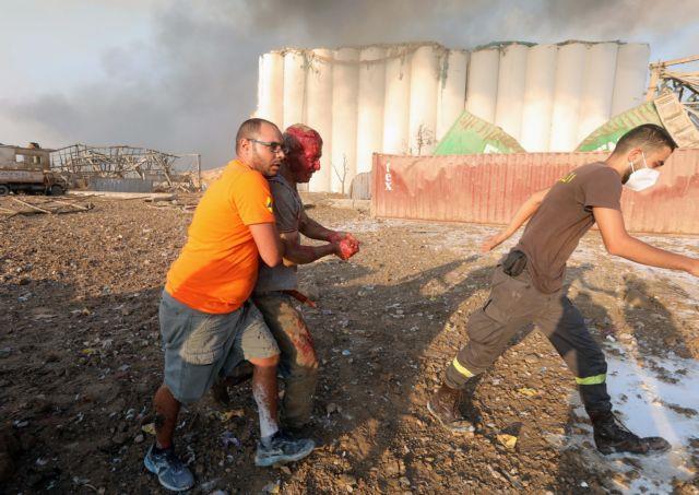 SENSITIVE MATERIAL. THIS IMAGE MAY OFFEND OR DISTURB. An injured man is helped following an explosion in Beirut