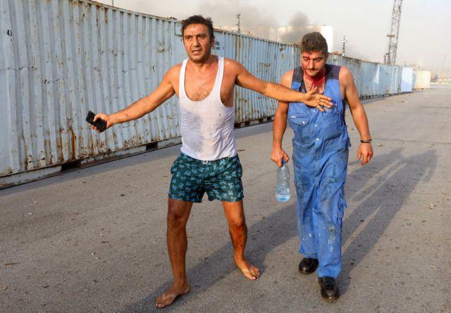 SENSITIVE MATERIAL. THIS IMAGE MAY OFFEND OR DISTURB Injured men are seen following an explosion in Beirut