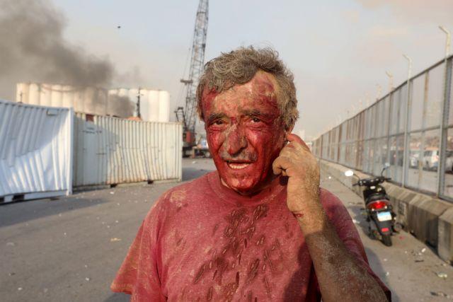 SENSITIVE MATERIAL. THIS IMAGE MAY OFFEND OR DISTURB An injured man is seen following an explosion in Beirut