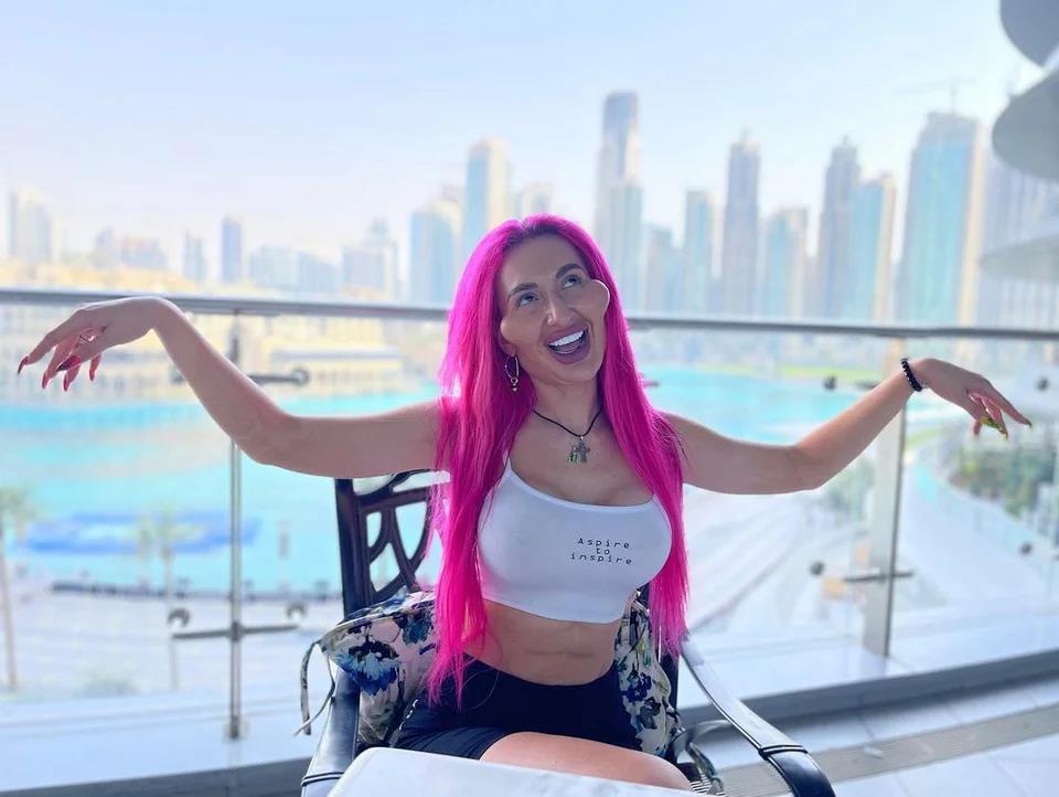 3995788860417690 image