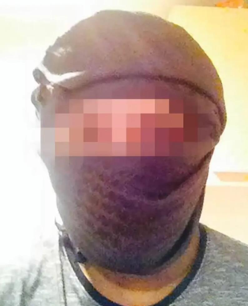 3998953589351590 image