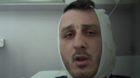 «Μου δάγκωσε το αυτί, φώναζε ‘είμαι Χαμάς’»-Άγρια συμπλοκή μεταξύ Ισραηλινού και Σύρου στην Ελλάδα
