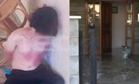 Σε αμόκ ο 28χρονος δολοφόνος 47χρονης στο Χαλάνδρι-Έσπασε η λάμα του πρώτου μαχαιριού και έβγαλε και δεύτερο