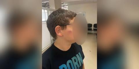 Ενδεκάχρονος ξυλοκοπήθηκε σε σχολείο στη Θεσσαλονίκη-«Η διευθύντρια μου είπε να του μάθω να μην δίνει σημασία στο bullying»
