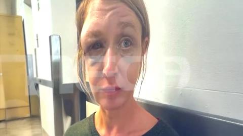 Σε άρνηση η 40χρονη που ξυλοκοπήθηκε βάναυσα από τον σύντροφό της στην Ελλάδα-Δηλώνει ότι δεν το θυμάται