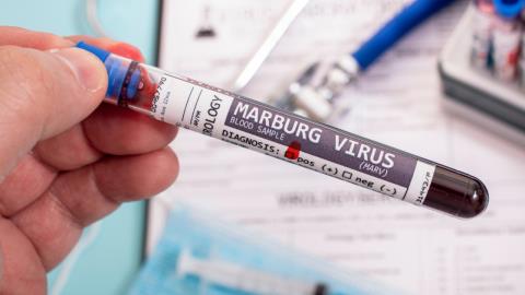 Κρούσματα του θανατηφόρου ιού Marburg ανακοίνωσε η Αιθιοπία