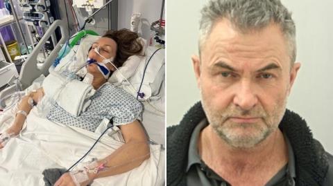 Ισόβια παράλυτη 57χρονη μετά τον άγριο ξυλοδαρμό από τον σύντροφό της στη Βρετανία-Της έσπασε το λαιμό