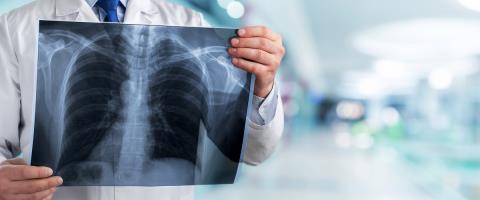 Στα πλάνα του ΟΑΥ η πρόσβαση σε ακτινογραφίες μέσω ΓεΣΥ-Πρόβλημα ο τεράστιος όγκος αρχείων