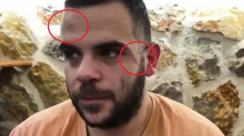 Ξυλοκόπησαν άγρια τον Youtuber «Teosty» σε live μετάδοση στα Γιάννενα-Τον χτύπησαν σε σώμα και πρόσωπο