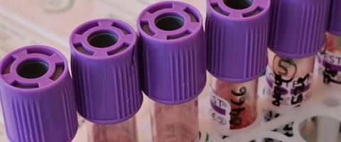 &Sigma;&epsilon; &kappa;ί&nu;&delta;&upsilon;&nu;&omicron; &gamma;&iota;&alpha; ά&lambda;&lambda;&eta; &mu;ί&alpha; &phi;&omicron;&rho;ά &omicron;&iota; &theta;&alpha;&lambda;&alpha;&sigma;&sigma;&alpha;&iota;&mu;&iota;&kappa;&omicron;ί, &sigma;&upsilon;&nu;&epsilon;&chi;&epsilon;ί&sigmaf; &alpha;&nu;&alpha;&beta;&omicron;&lambda;έ&sigmaf; &mu;&epsilon;&tau;&alpha;&gamma;&gamma;ί&sigma;&epsilon;&omega;&nu;-&Kappa;ά&tau;&omega; &alpha;&pi;ό &tau;&alpha; &alpha;&sigma;&phi;&alpha;&lambda;ή &epsilon;&pi;ί&pi;&epsilon;&delta;&alpha; &tau;&alpha; &alpha;&pi;&omicron;&theta;έ&mu;&alpha;&tau;&alpha; &alpha;ί&mu;&alpha;&tau;&omicron;&sigmaf;