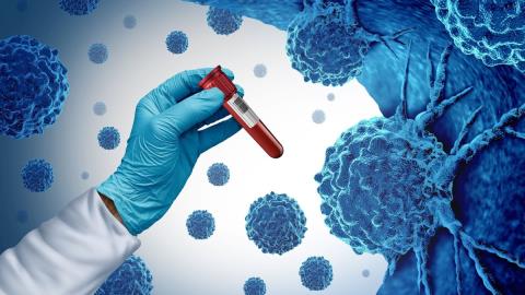 &Sigma;&chi;&epsilon;&delta;ό&nu; 5 &epsilon;&kappa;. &epsilon;&xi;&iota;&tau;ή&rho;&iota;&alpha; &sigma;&epsilon; &alpha;&sigma;&theta;&epsilon;&nu;&epsilon;ί&sigmaf; &mu;&epsilon; &kappa;&alpha;&rho;&kappa;ί&nu;&omicron; &alpha;&pi;ό &nu;&omicron;&sigma;&omicron;&kappa;&omicron;&mu;&epsilon;ί&alpha; &Epsilon;&Epsilon; &tau;&omicron; 2023-&Sigma;&tau;&omicron;&nu; &mu;έ&sigma;&omicron; ό&rho;&omicron; &eta; &Kappa;ύ&pi;&rho;&omicron;&sigmaf;